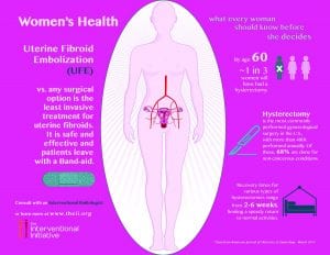 UFE UAE uterine fibroid doctor socal los angeles